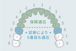 保険適応・診断により6番目も適応