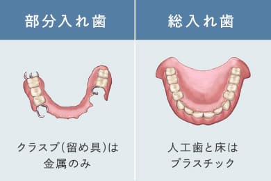 部分入れ歯（クラスプが無いものなどの選択が可能／総入れ歯（金属床など様々な素材の選択が可能）