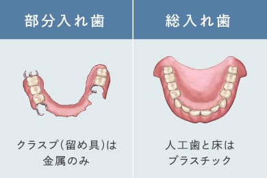 部分入れ歯（クラスプが無いものなどの選択が可能／総入れ歯（金属床など様々な素材の選択が可能）