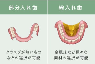 部分入れ歯（クラスプが無いものなどの選択が可能／総入れ歯（金属床など様々な素材の選択が可能）