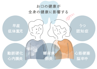 お口の健康が全身の健康に影響する…早産・低体重児／動脈硬化・心内膜炎／糖尿病・肺炎／心筋梗塞・脳卒中／うつ・認知症