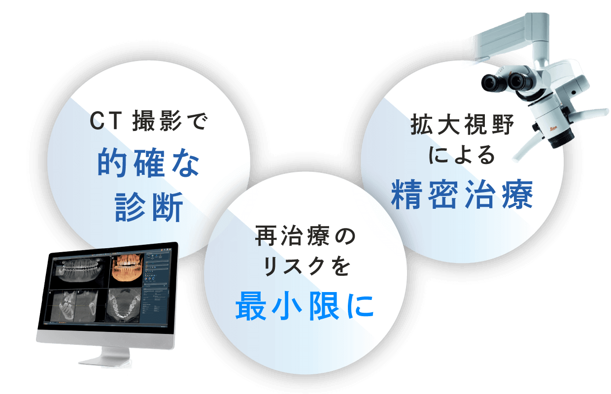 CT撮影で的確な診断／再治療のリスクや痛みを最小限に／拡大視野による精密治療